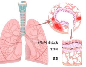 中医治疗肺气肿效果好吗